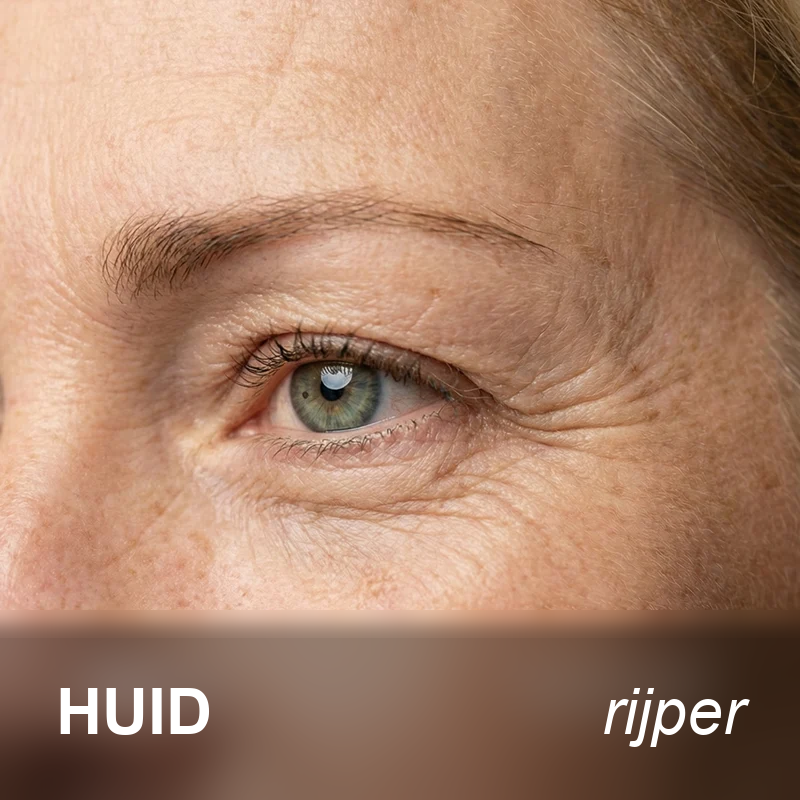 Rijpere huid rond de ogen