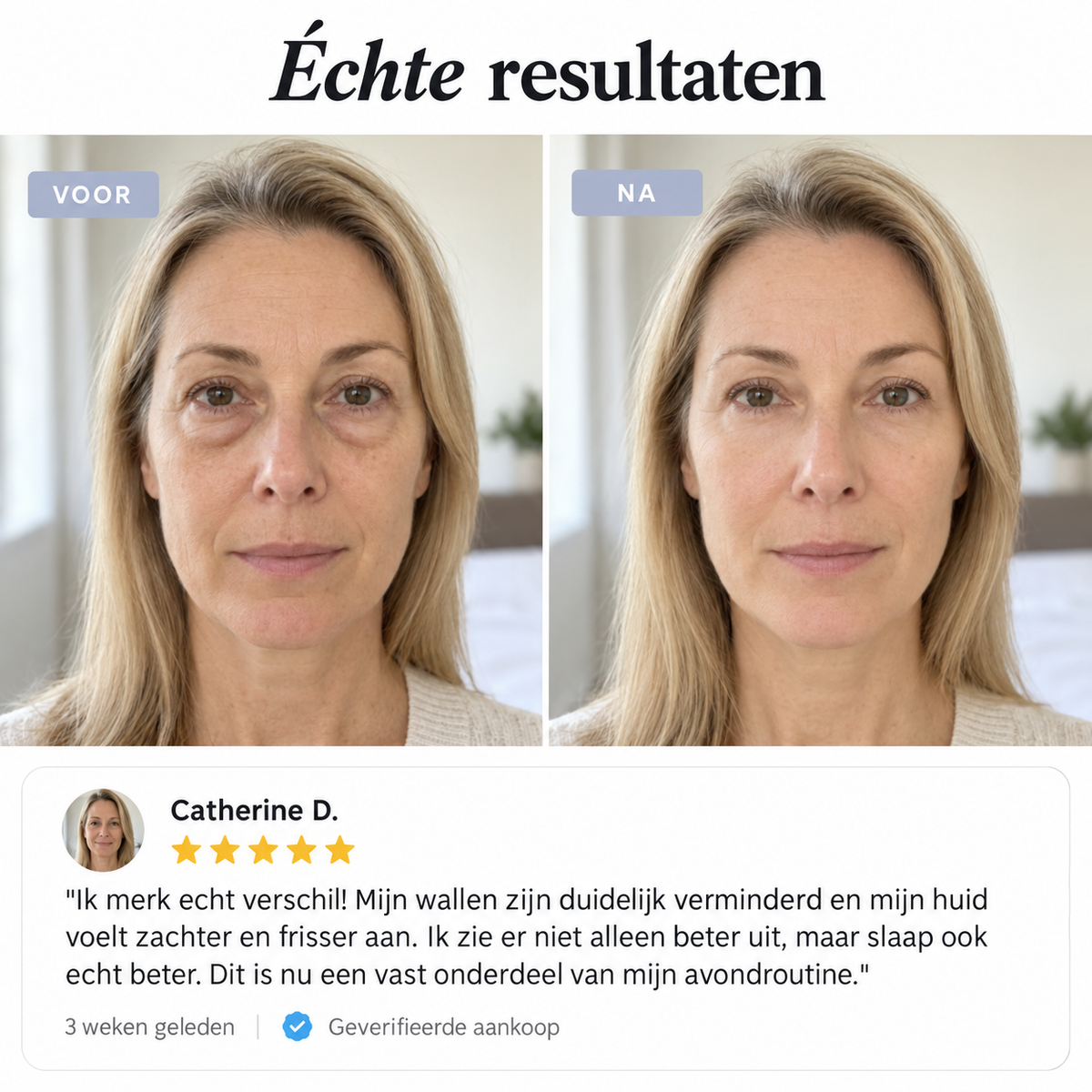 Echte resultaten: voor en na